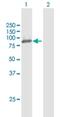 Oxysterol Binding Protein Like 10 antibody, H00114884-D01P, Novus Biologicals, Western Blot image 