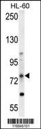 ATP Binding Cassette Subfamily D Member 1 antibody, MBS9203294, MyBioSource, Western Blot image 