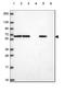 Glycerophosphodiester Phosphodiesterase Domain Containing 5 antibody, NBP2-49438, Novus Biologicals, Western Blot image 