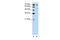 Forkhead Box B2 antibody, 29-807, ProSci, Western Blot image 