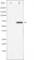 Zeta Chain Of T Cell Receptor Associated Protein Kinase 70 antibody, abx012371, Abbexa, Western Blot image 