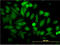 Enolase 1 antibody, LS-B4318, Lifespan Biosciences, Immunofluorescence image 