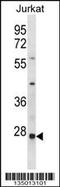 Oxidoreductase HTATIP2 antibody, 57-970, ProSci, Western Blot image 