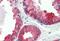 Prostate Stem Cell Antigen antibody, MBS242517, MyBioSource, Immunohistochemistry paraffin image 