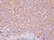 Dual Serine/Threonine And Tyrosine Protein Kinase antibody, GTX107925, GeneTex, Immunohistochemistry paraffin image 