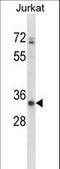 ADP-Ribosyltransferase 3 antibody, LS-C156523, Lifespan Biosciences, Western Blot image 