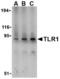 Toll Like Receptor 1 antibody, TA306265, Origene, Western Blot image 