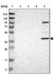 Purinergic Receptor P2Y12 antibody, NBP1-89673, Novus Biologicals, Western Blot image 