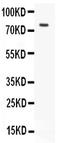 LHRHR antibody, LS-C312710, Lifespan Biosciences, Western Blot image 