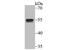 CUGBP Elav-Like Family Member 1 antibody, NBP2-75457, Novus Biologicals, Western Blot image 
