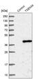 tRNA-splicing endonuclease subunit Sen34 antibody, PA5-59430, Invitrogen Antibodies, Western Blot image 