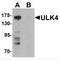 Unc-51 Like Kinase 4 antibody, MBS153597, MyBioSource, Western Blot image 