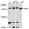 PAS Domain Containing Serine/Threonine Kinase antibody, A8995, ABclonal Technology, Western Blot image 