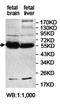 Katanin Catalytic Subunit A1 antibody, orb78109, Biorbyt, Western Blot image 
