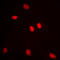 Adenosine Deaminase RNA Specific B1 antibody, LS-C351788, Lifespan Biosciences, Immunofluorescence image 