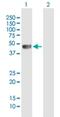 Zinc Finger And SCAN Domain Containing 4 antibody, H00201516-B01P, Novus Biologicals, Western Blot image 