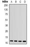 Interleukin 1 Family Member 10 antibody, orb339154, Biorbyt, Western Blot image 