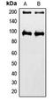 Insulin Like Growth Factor 1 Receptor antibody, LS-C352356, Lifespan Biosciences, Western Blot image 