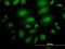 Ankyrin Repeat And Sterile Alpha Motif Domain Containing 1A antibody, H00023294-B01P, Novus Biologicals, Immunocytochemistry image 