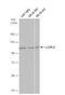 Lysyl Oxidase Like 2 antibody, NBP1-32954, Novus Biologicals, Western Blot image 