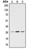 Ephrin A4 antibody, orb213875, Biorbyt, Western Blot image 