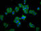 Carbamoyl-Phosphate Synthase 1 antibody, LS-C669845, Lifespan Biosciences, Immunofluorescence image 