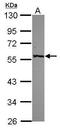 Glutamic--Pyruvic Transaminase antibody, GTX112952, GeneTex, Western Blot image 