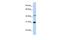 Nucleoporin 35 antibody, GTX45750, GeneTex, Western Blot image 