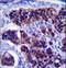 Zinc Finger DHHC-Type Containing 24 antibody, LS-C160762, Lifespan Biosciences, Immunohistochemistry paraffin image 