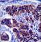 Zinc Finger DHHC-Type Containing 24 antibody, LS-C160762, Lifespan Biosciences, Immunohistochemistry paraffin image 