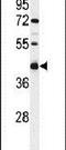 Transmembrane Protein 268 antibody, PA5-26996, Invitrogen Antibodies, Western Blot image 