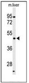 Cyclin Dependent Kinase 14 antibody, AP52091PU-N, Origene, Western Blot image 