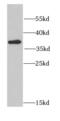Casein Kinase 2 Alpha 1 antibody, FNab02024, FineTest, Western Blot image 