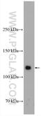 Oncostatin M Receptor antibody, 10982-1-AP, Proteintech Group, Western Blot image 
