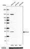 ADP Ribosylation Factor Like GTPase 4C antibody, NBP1-88988, Novus Biologicals, Western Blot image 