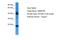 Transmembrane Protein 186 antibody, A18047, Boster Biological Technology, Western Blot image 