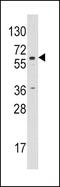 Cytochrome P450 Family 19 Subfamily A Member 1 antibody, PA5-14517, Invitrogen Antibodies, Western Blot image 
