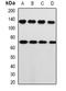 Protein Kinase CGMP-Dependent 1 antibody, orb381986, Biorbyt, Western Blot image 