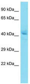 Nucleoside diphosphate kinase 7 antibody, TA331277, Origene, Western Blot image 