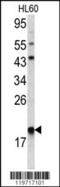 ARPC3 antibody, 62-355, ProSci, Western Blot image 