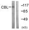 Cbl Proto-Oncogene antibody, LS-C117634, Lifespan Biosciences, Western Blot image 