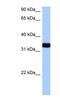 GTPase, IMAP Family Member 1 antibody, NBP1-59488, Novus Biologicals, Western Blot image 