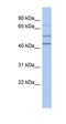 NEDD1 Gamma-Tubulin Ring Complex Targeting Factor antibody, orb330705, Biorbyt, Western Blot image 