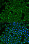 Cysteinyl-TRNA Synthetase antibody, 15-143, ProSci, Immunofluorescence image 