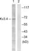 Potassium Voltage-Gated Channel Subfamily C Member 4 antibody, LS-B11349, Lifespan Biosciences, Western Blot image 