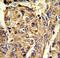 Heterogeneous Nuclear Ribonucleoprotein L antibody, LS-C164965, Lifespan Biosciences, Immunohistochemistry paraffin image 