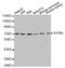 Synoviolin 1 antibody, A02670, Boster Biological Technology, Western Blot image 