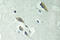 Protein Tyrosine Kinase 2 antibody, LS-C177635, Lifespan Biosciences, Immunohistochemistry paraffin image 