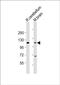 Unc-5 Netrin Receptor B antibody, PA5-49453, Invitrogen Antibodies, Western Blot image 