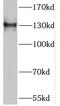 Tensin 3 antibody, FNab08847, FineTest, Western Blot image 